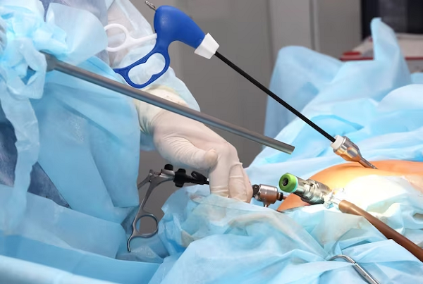 Laparoscopic and Robotic Surgery